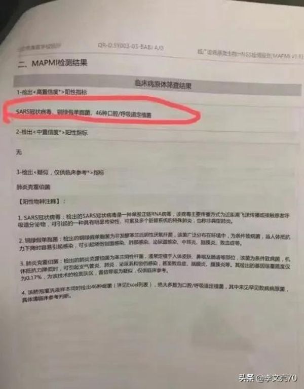 因发布疫情被训诫的医生李文亮确诊感染新冠