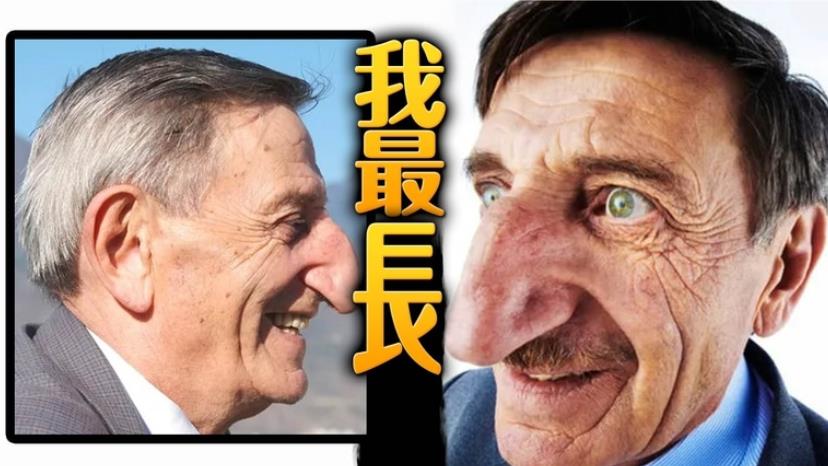 纪录已保持20年 世界最长鼻男人
