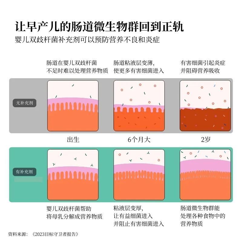 给高危婴儿服用婴儿双歧杆菌作为益生菌补充剂